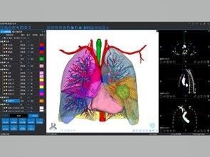 Usługi rekonstrukcji medycznej 3D i druku 3D